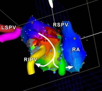 Three-dimensional structure of the heart