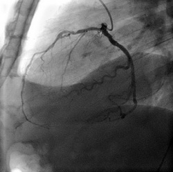 sait_angiografichne_doslidzhennya_1a