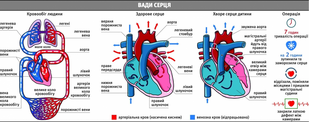 25-03-16 Газета по укр1